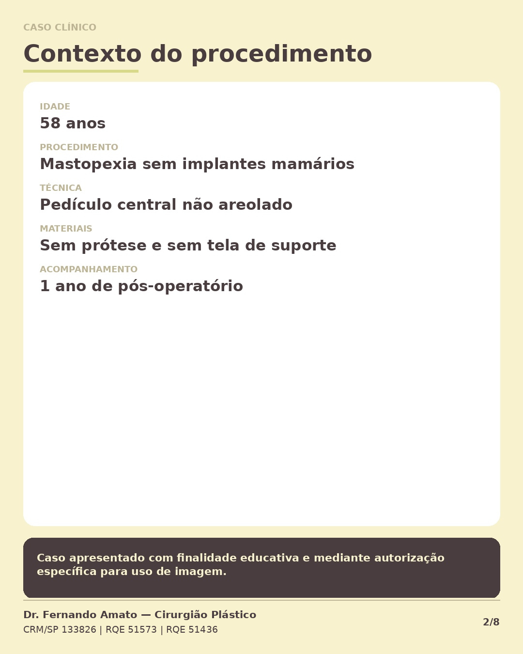 Ficha do caso clínico: paciente de 58 anos, mastopexia sem implantes, técnica de pedículo central não areolado, sem tela de suporte, seguimento de 1 ano